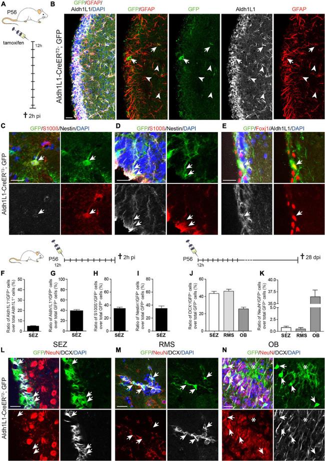 FOXJ1 Antibody in Immunohistochemistry (IHC)