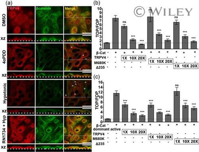 beta Catenin Antibody in Immunocytochemistry (ICC/IF)