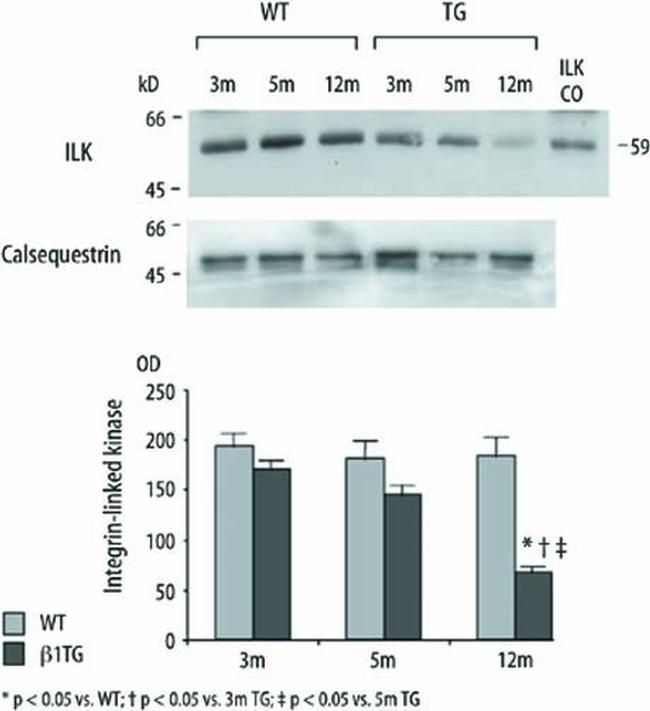 Calsequestrin Antibody in Western Blot (WB)