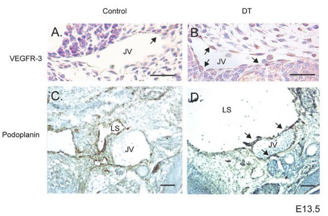 VEGF Receptor 3 Antibody in Immunohistochemistry (IHC)