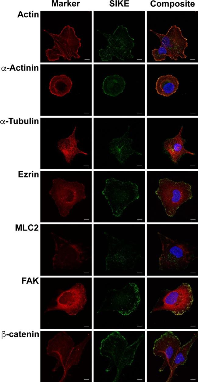 Ezrin Antibody in Immunocytochemistry (ICC/IF)