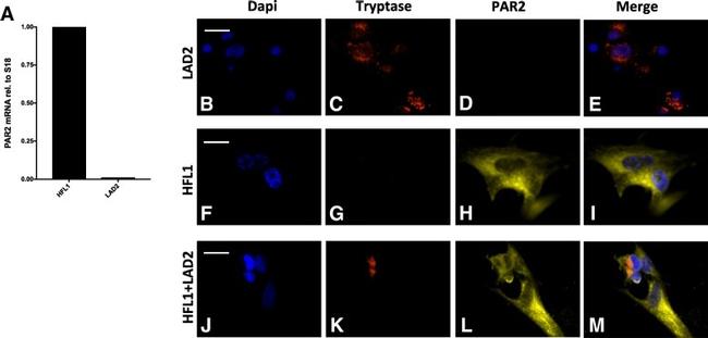 PAR2 Antibody in Immunocytochemistry (ICC/IF)