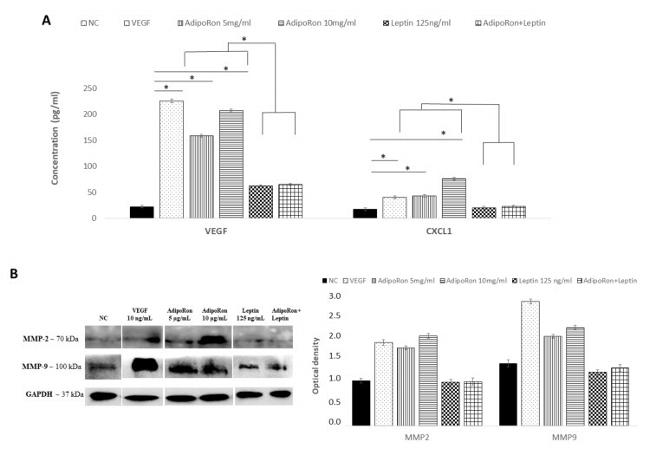 MMP2 Antibody in Western Blot (WB)