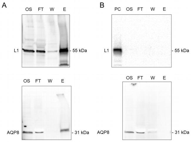 HPV Type 16 L1 Antibody in Immunoprecipitation (IP)