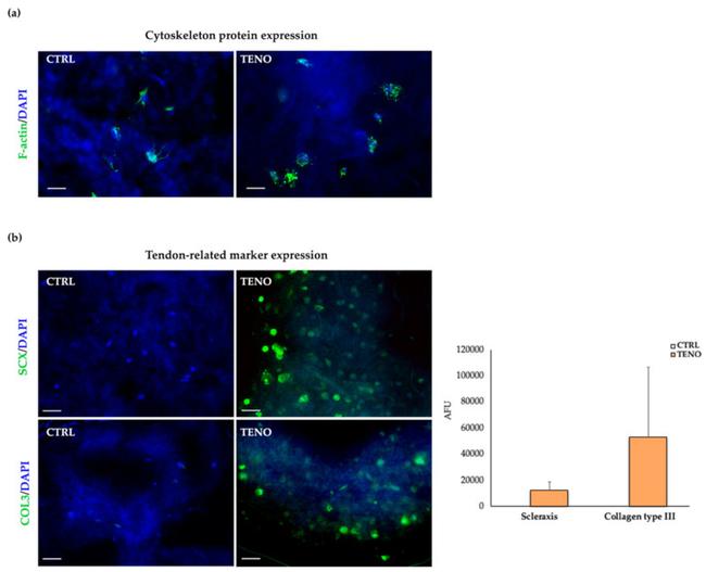 Collagen III Antibody in Immunocytochemistry (ICC/IF)