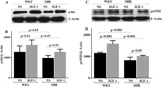 Phospho-eNOS (Ser1177) Antibody in Western Blot (WB)