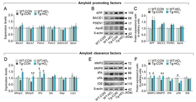 beta Amyloid Antibody in Western Blot (WB)