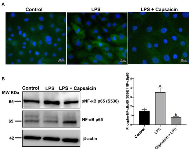 Phospho-NFkB P65 (Ser536) Monoclonal Antibody (T.849.2) (MA5-15160)