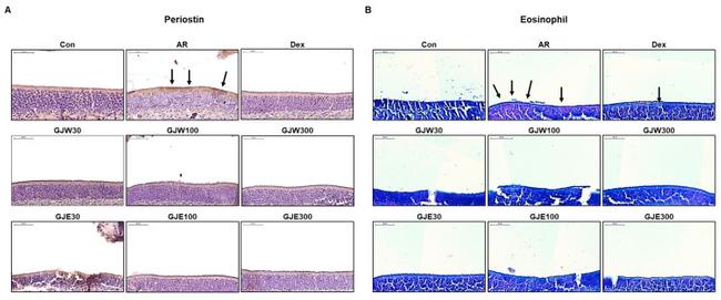 Periostin Antibody in Immunohistochemistry (IHC)