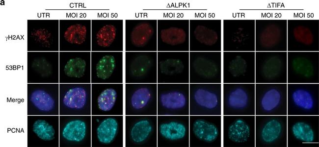 Mouse IgG (H+L) Highly Cross-Adsorbed Secondary Antibody in Immunocytochemistry (ICC/IF)