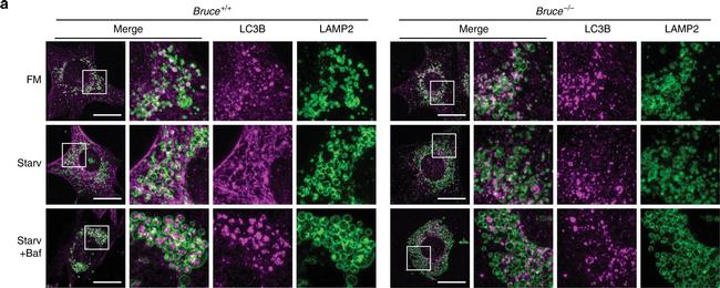 Mouse IgG (H+L) Highly Cross-Adsorbed Secondary Antibody in Immunocytochemistry (ICC/IF)