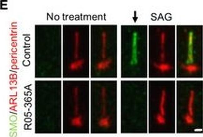 Rabbit IgG (H+L) Highly Cross-Adsorbed Secondary Antibody in Immunohistochemistry (IHC)