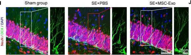 Rabbit IgG (H+L) Highly Cross-Adsorbed Secondary Antibody in Immunohistochemistry (IHC)