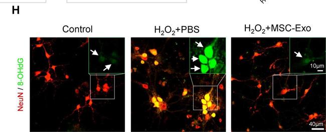 Rabbit IgG (H+L) Highly Cross-Adsorbed Secondary Antibody in Immunohistochemistry (IHC)