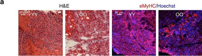 Rabbit IgG (H+L) Cross-Adsorbed Secondary Antibody in Immunohistochemistry (IHC)