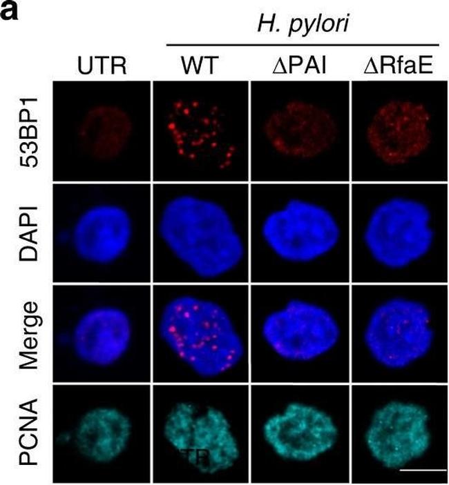 Mouse IgG (H+L) Highly Cross-Adsorbed Secondary Antibody in Immunocytochemistry (ICC/IF)