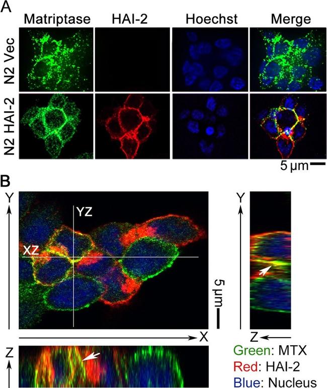 Mouse IgG (H+L) Secondary Antibody in Immunocytochemistry (ICC/IF)