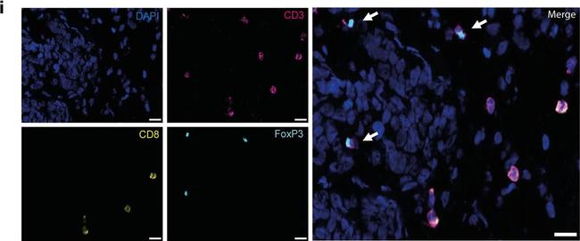 Rabbit IgG (H+L) Highly Cross-Adsorbed Secondary Antibody in Immunocytochemistry (ICC/IF)