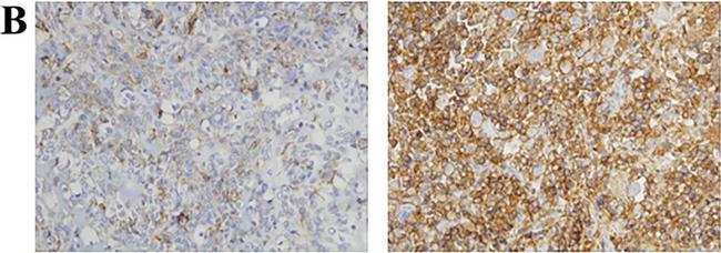 Rat IgG (H+L) Secondary Antibody in Immunohistochemistry (Paraffin) (IHC (P))