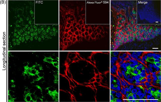 Sheep IgG (H+L) Cross-Adsorbed Secondary Antibody in Immunohistochemistry (IHC)