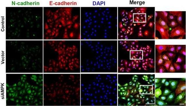 Rabbit IgG (H+L) Secondary Antibody in Immunocytochemistry (ICC/IF)