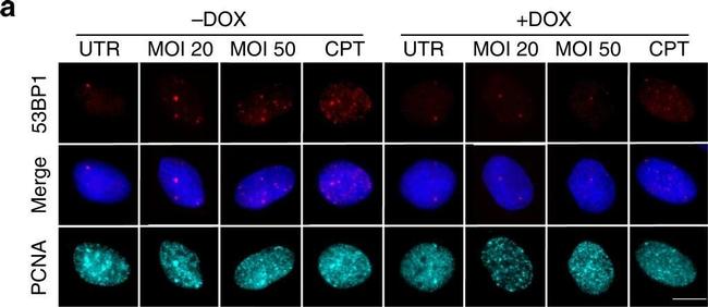 Mouse IgG (H+L) Highly Cross-Adsorbed Secondary Antibody in Immunocytochemistry (ICC/IF)