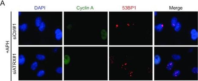 Rabbit IgG (H+L) Cross-Adsorbed Secondary Antibody in Immunocytochemistry (ICC/IF)