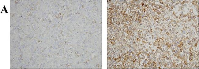 Rat IgG (H+L) Secondary Antibody in Immunohistochemistry (Paraffin) (IHC (P))