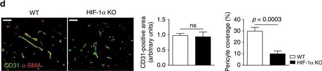 Mouse IgG (H+L) Highly Cross-Adsorbed Secondary Antibody in Immunohistochemistry (Paraffin) (IHC (P))