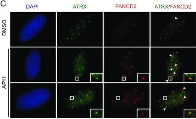 Rabbit IgG (H+L) Cross-Adsorbed Secondary Antibody in Immunocytochemistry (ICC/IF)