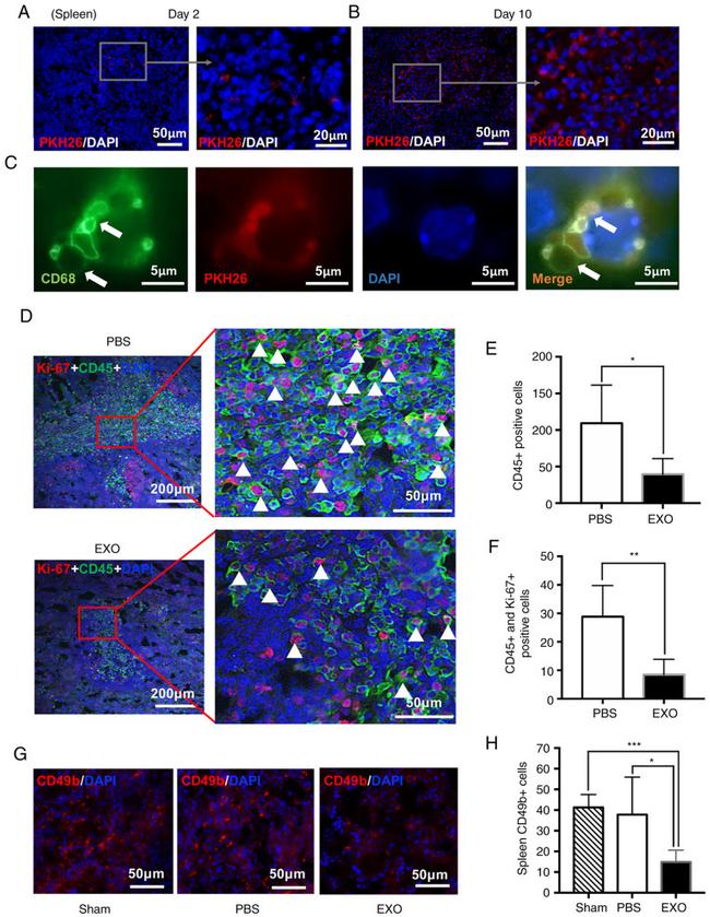 CD49b (Integrin alpha 2) Antibody in Immunohistochemistry (IHC)