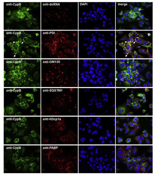 SQSTM1 Antibody in Immunocytochemistry (ICC/IF)