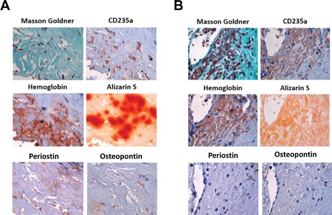 Periostin Antibody in Immunohistochemistry (IHC)