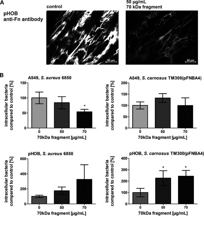 Fibronectin Antibody in Immunohistochemistry (IHC)