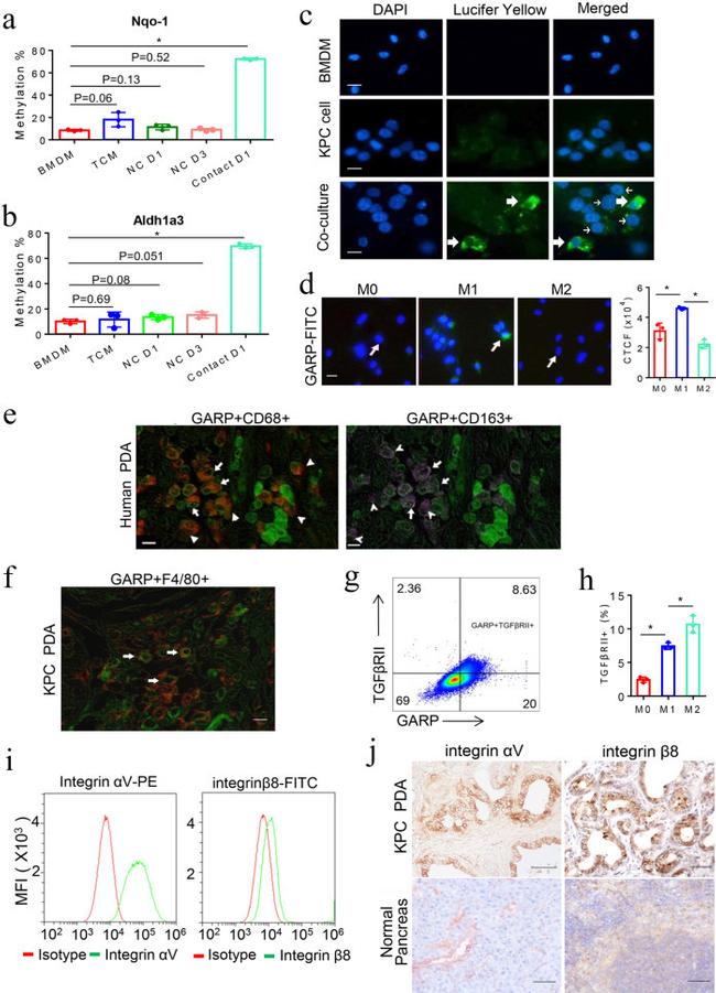 CD163 Antibody in Immunohistochemistry (IHC)