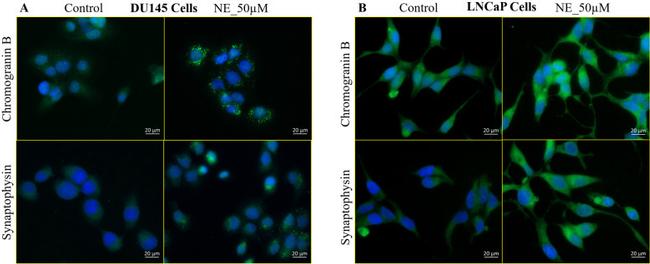 Chromogranin B Antibody in Immunocytochemistry (ICC/IF)