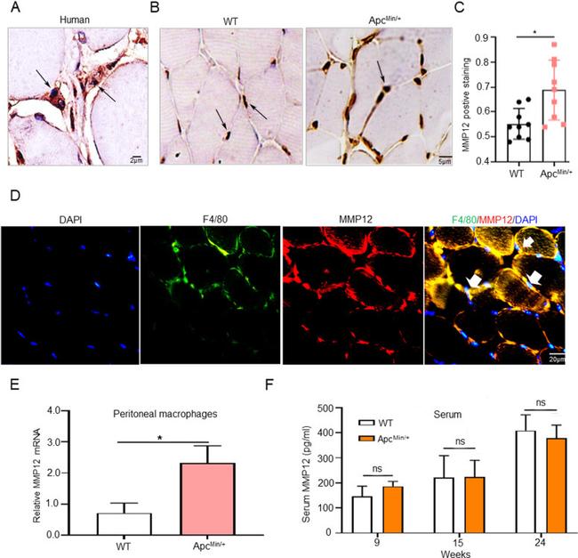 MMP12 Antibody in Immunohistochemistry (IHC)