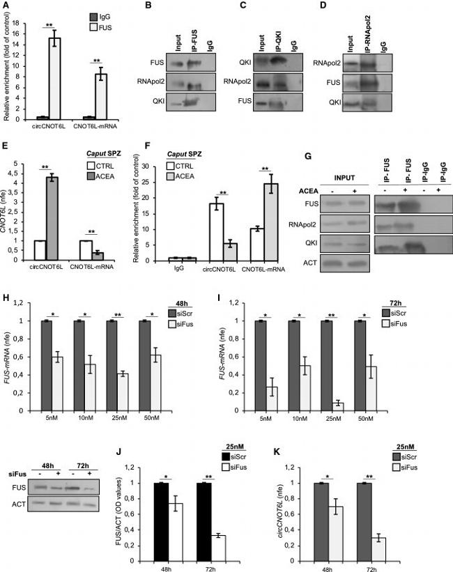 QKI Antibody in Western Blot, Immunoprecipitation (WB, IP)