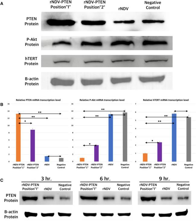 beta Actin Antibody in Western Blot (WB)