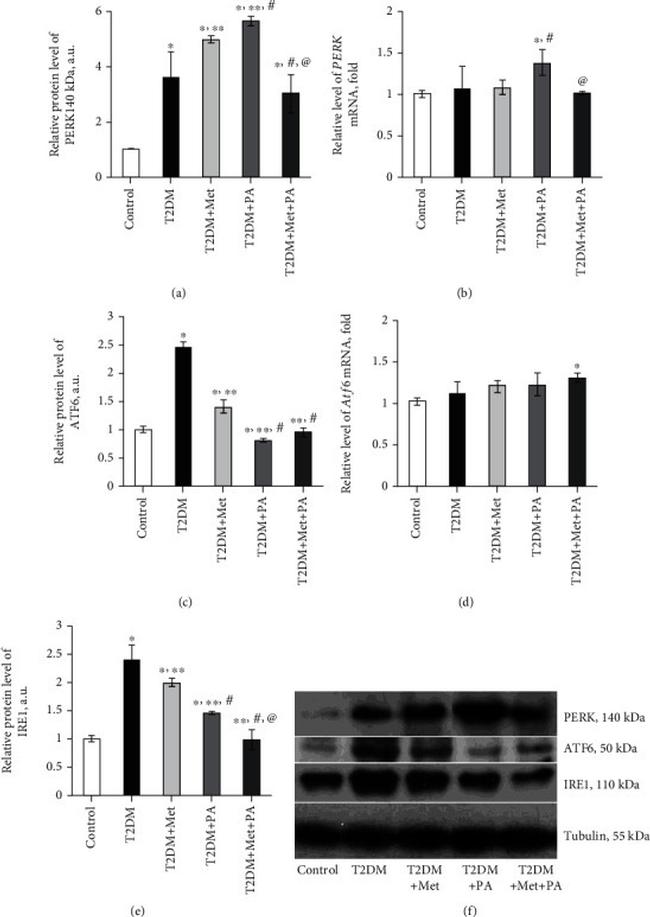 PERK Antibody in Western Blot (WB)