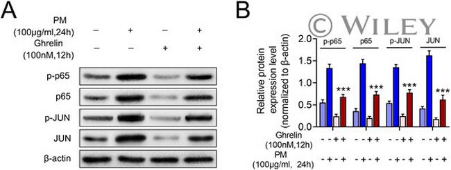 NFkB p65 Antibody in Western Blot (WB)