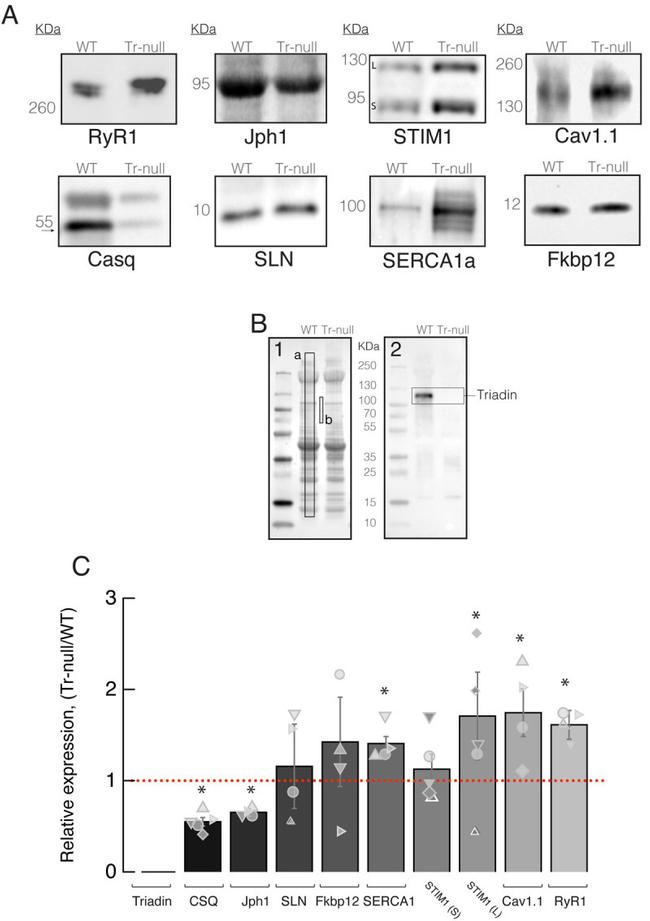 SERCA1 ATPase Antibody in Western Blot (WB)