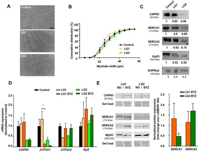 SERCA1 ATPase Antibody in Western Blot (WB)