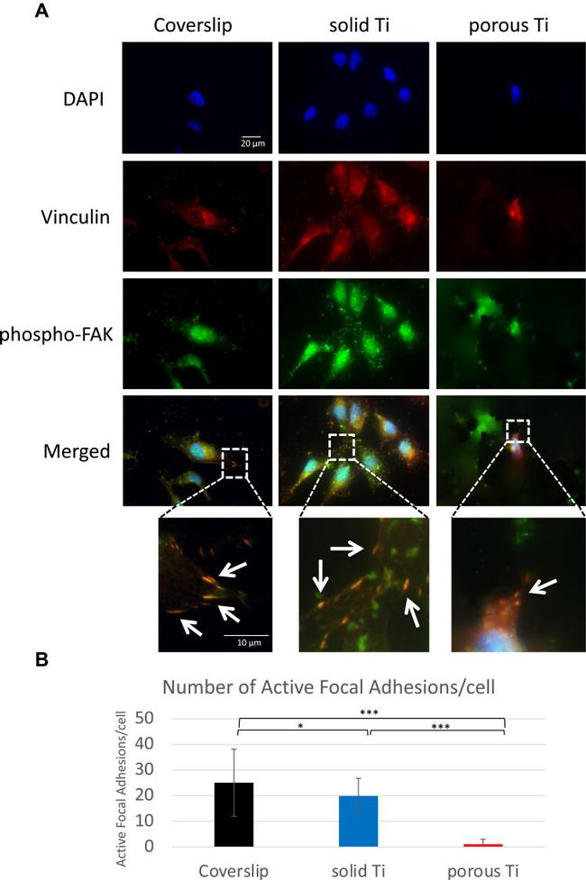 Phospho-FAK (Tyr397) Antibody in Immunocytochemistry (ICC/IF)