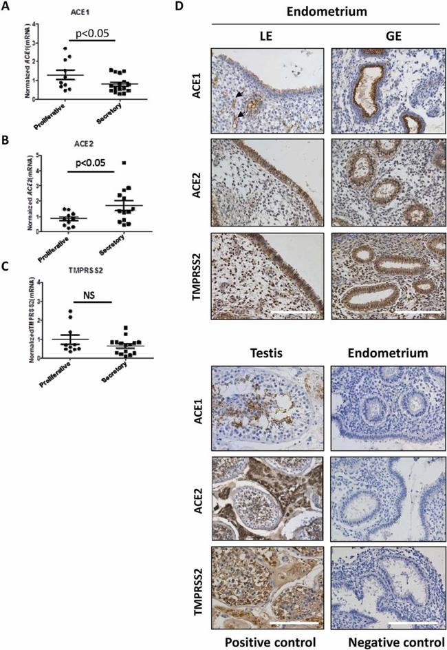 ACE2 Antibody in Immunohistochemistry (IHC)