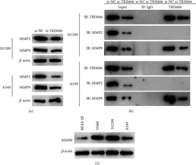 MMP2 Antibody in Western Blot (WB)