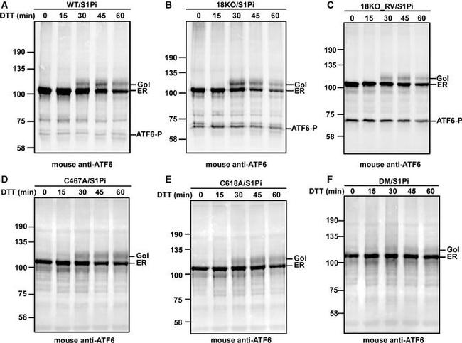 Mouse IgG (H+L) Highly Cross-Adsorbed Secondary Antibody in Western Blot (WB)