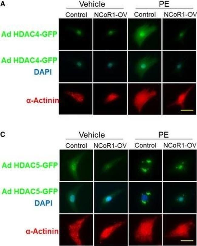 Mouse IgG (H+L) Highly Cross-Adsorbed Secondary Antibody in Immunocytochemistry (ICC/IF)