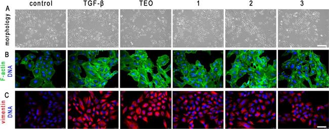 Rabbit IgG (H+L) Cross-Adsorbed Secondary Antibody in Immunocytochemistry (ICC/IF)