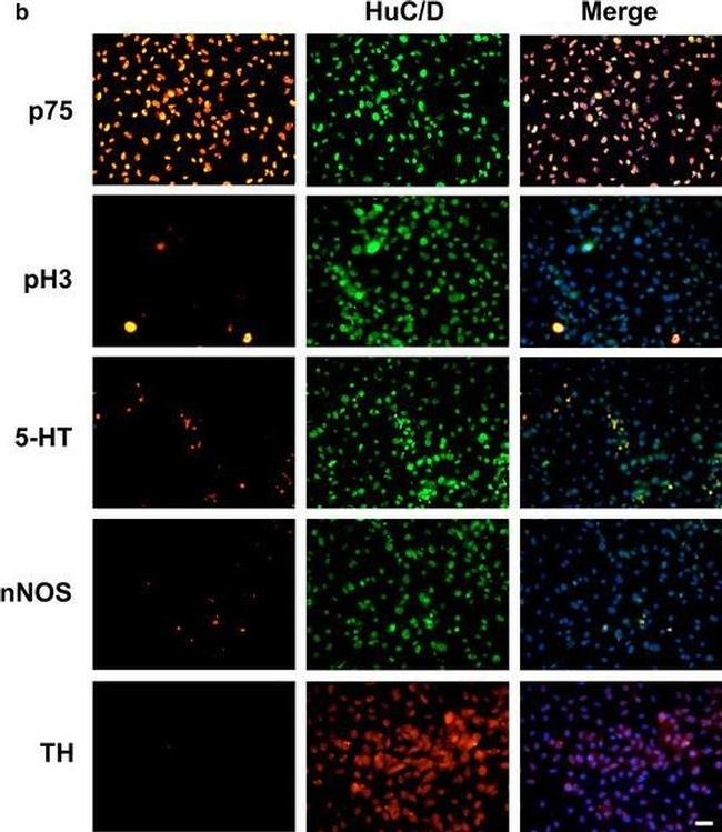 Rabbit IgG (H+L) Highly Cross-Adsorbed Secondary Antibody in Immunocytochemistry (ICC/IF)